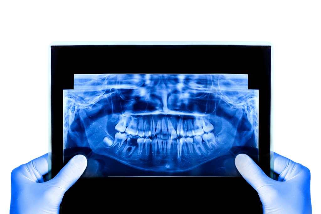 dental Radiologie canary radiología dental canarias