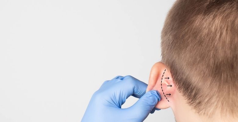 Clinica ICA, tu clínica estética en Canarias para realizar una otoplastia