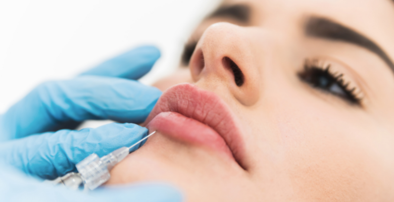 ácido hialurónico en los labios en el instituto de cirugía avanzada en Canarias Tenerife