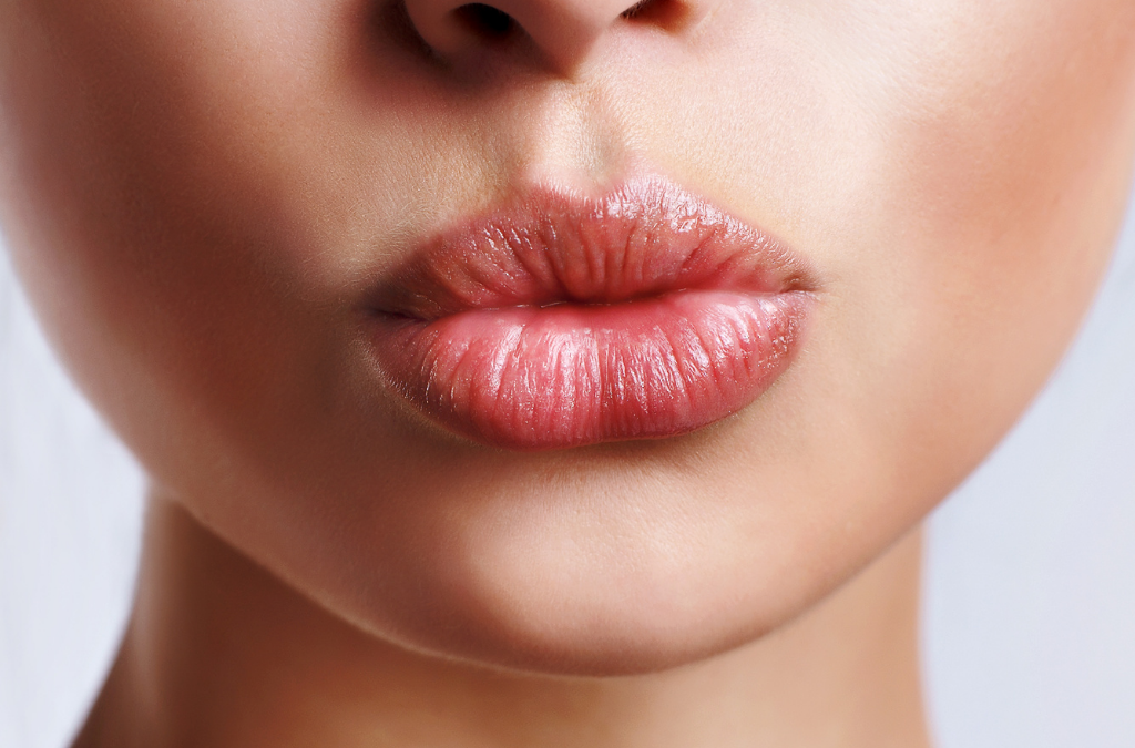 ¿Cuánto dura el Ácido Hialurónico en los labios?