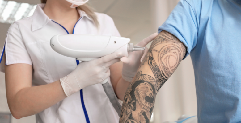 ¿duele quitar un tatuaje ¿cuánto cuesta quitar un tatuaje - nuevo artículo de Clínica ICA Canarias