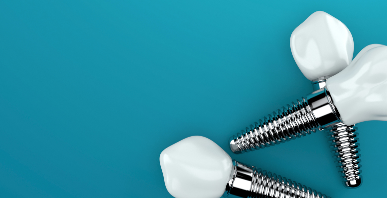 implantología dental, que consecuencias te pueden traer retirar un implante dental que ha fallado, Clínica ICA - Tenerife implantología dental, que consecuencias te pueden traer retirar un implante dental que ha fallado, Clínica ICA - Tenerife