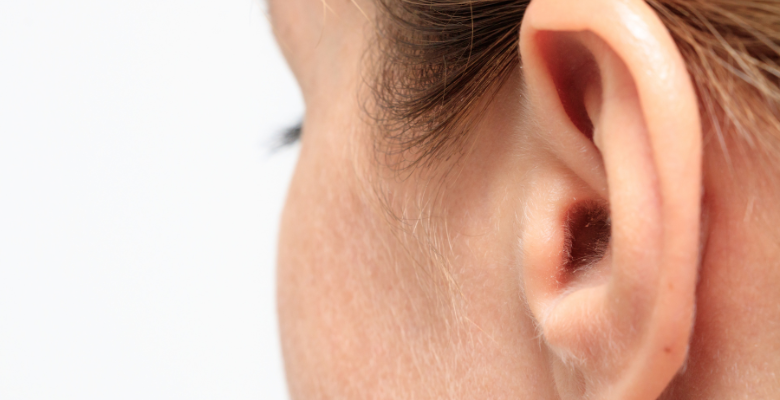La otoplastia es un procedimiento quirúrgico seguro y definitivo en la corrección de las orejas de soplillo