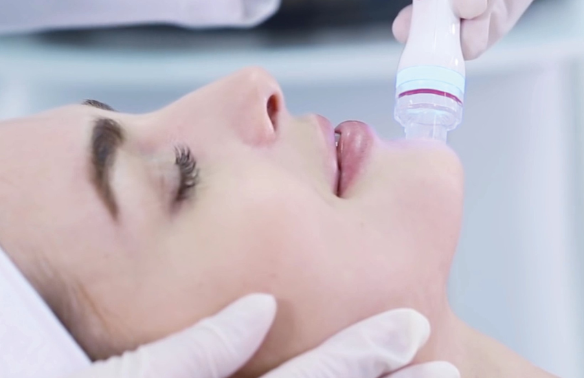 Microneedling para la mejora de tu piel