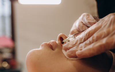 ¿Qué hay de nuevo en rellenos faciales? Ácido hialurónico, bioestimulación y más