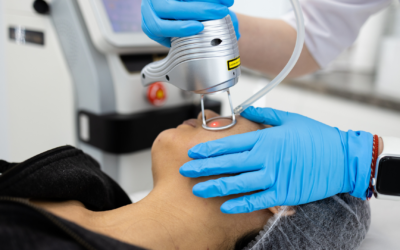 ¿Duele el láser? Mitos y realidades